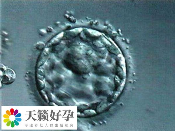 試管嬰兒優胚的成功率比較高
