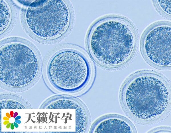 精卵質(zhì)量是影響試管嬰兒成功率的因素之一