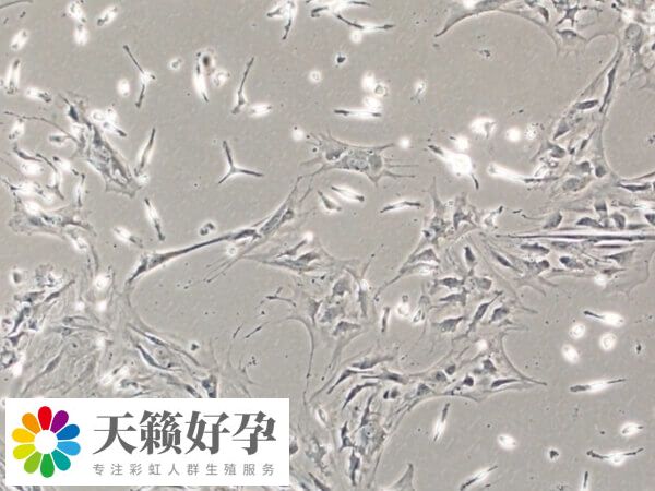 女女同性戀能用骨髓干細胞生孩子嗎？成功率高不高？