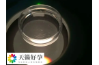 申請供精是否要檢查顯微鏡